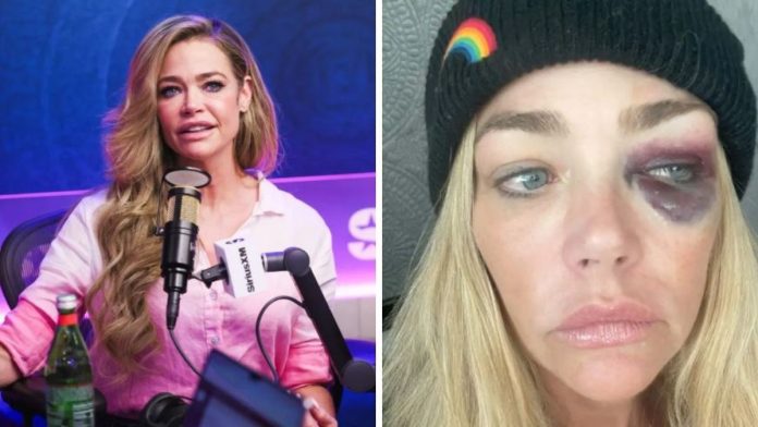 Denise Richards Accuses Ex of Stealing Private Nude Photos