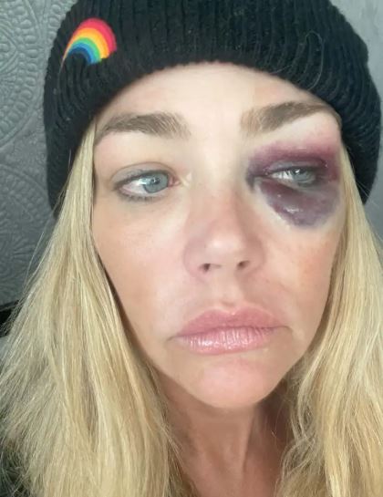 Denise Richards Accuses Ex Aaron Phypers of Stealing Private Nude Photos